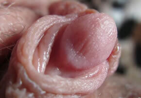 clitoris enorme
